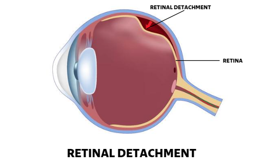 Anatomy Lesson: What Is the Retina? - Eye Care Specialists