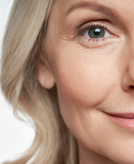 What is Blepharoplasty and How can I get one?